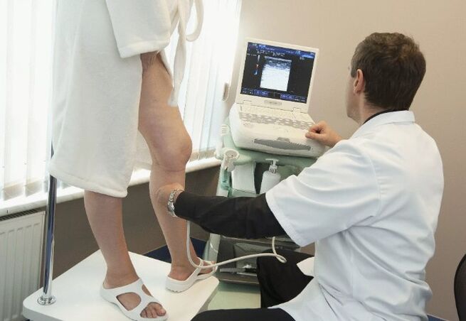 Diagnosi di vene varicose