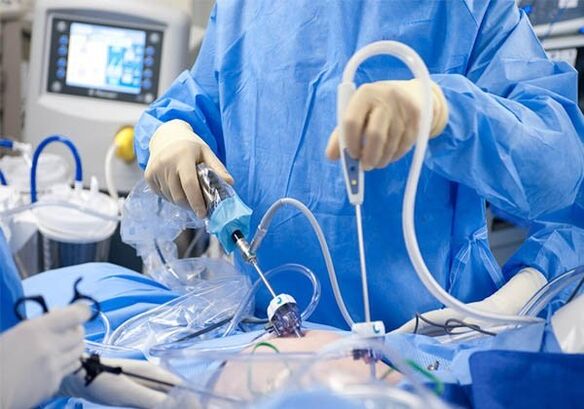 trattamento chirurgico delle vene varicose pelviche